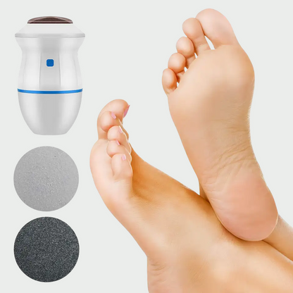 VelvetFeet™ Removedor de callos electrico
